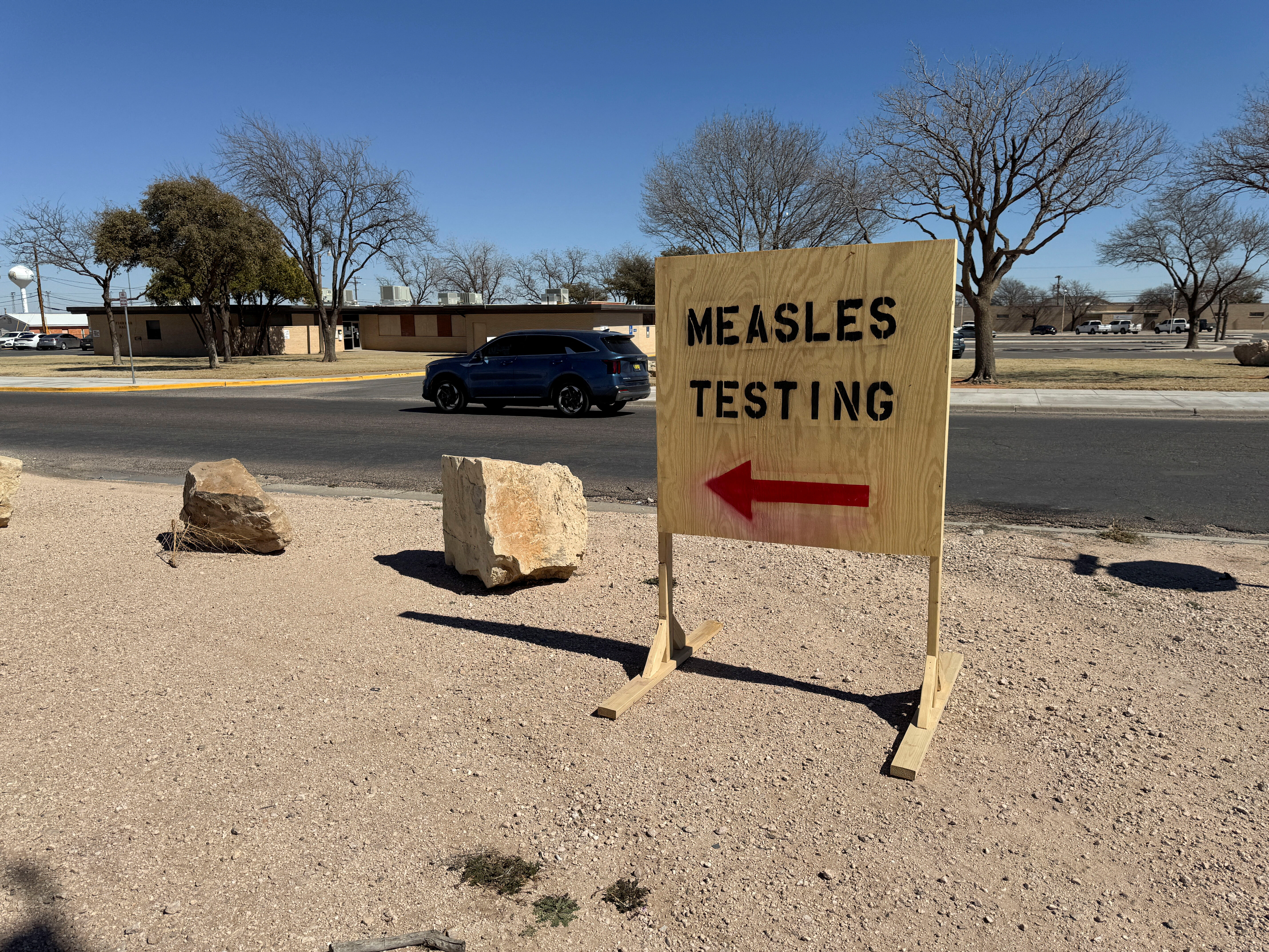 An unvaccinated child has died in the Texas measles outbreak